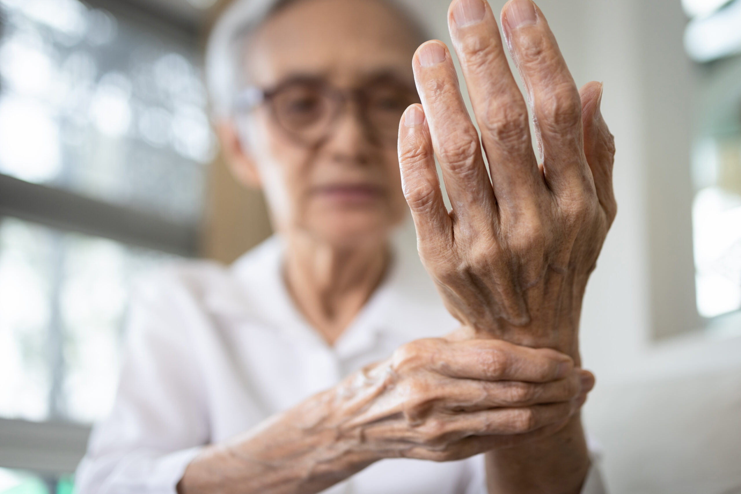 Elderly female patient suffer from numbing pain in hand,numbness