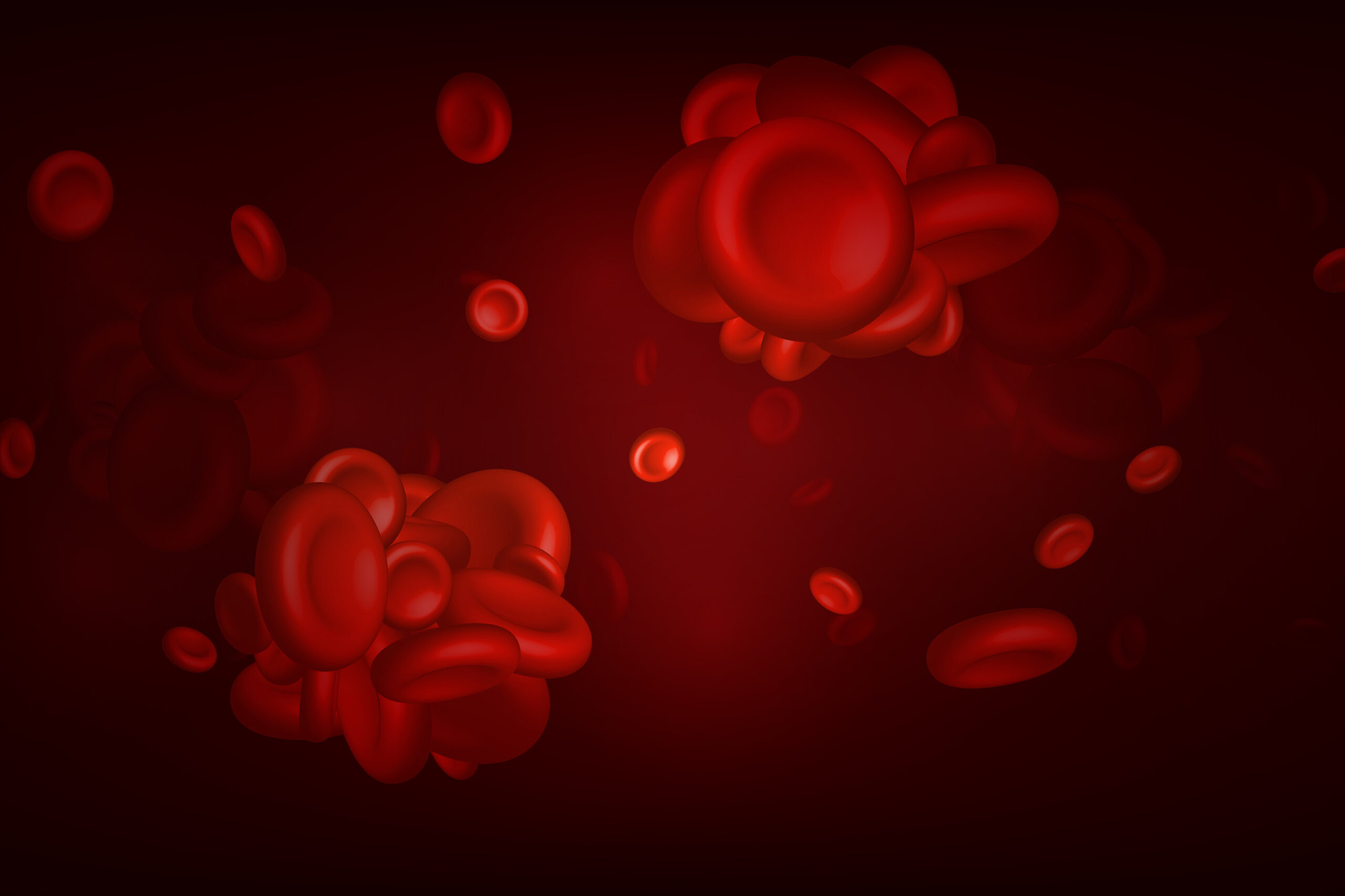 Blood clots, thrombus or embolus with coagulated erythrocytes.