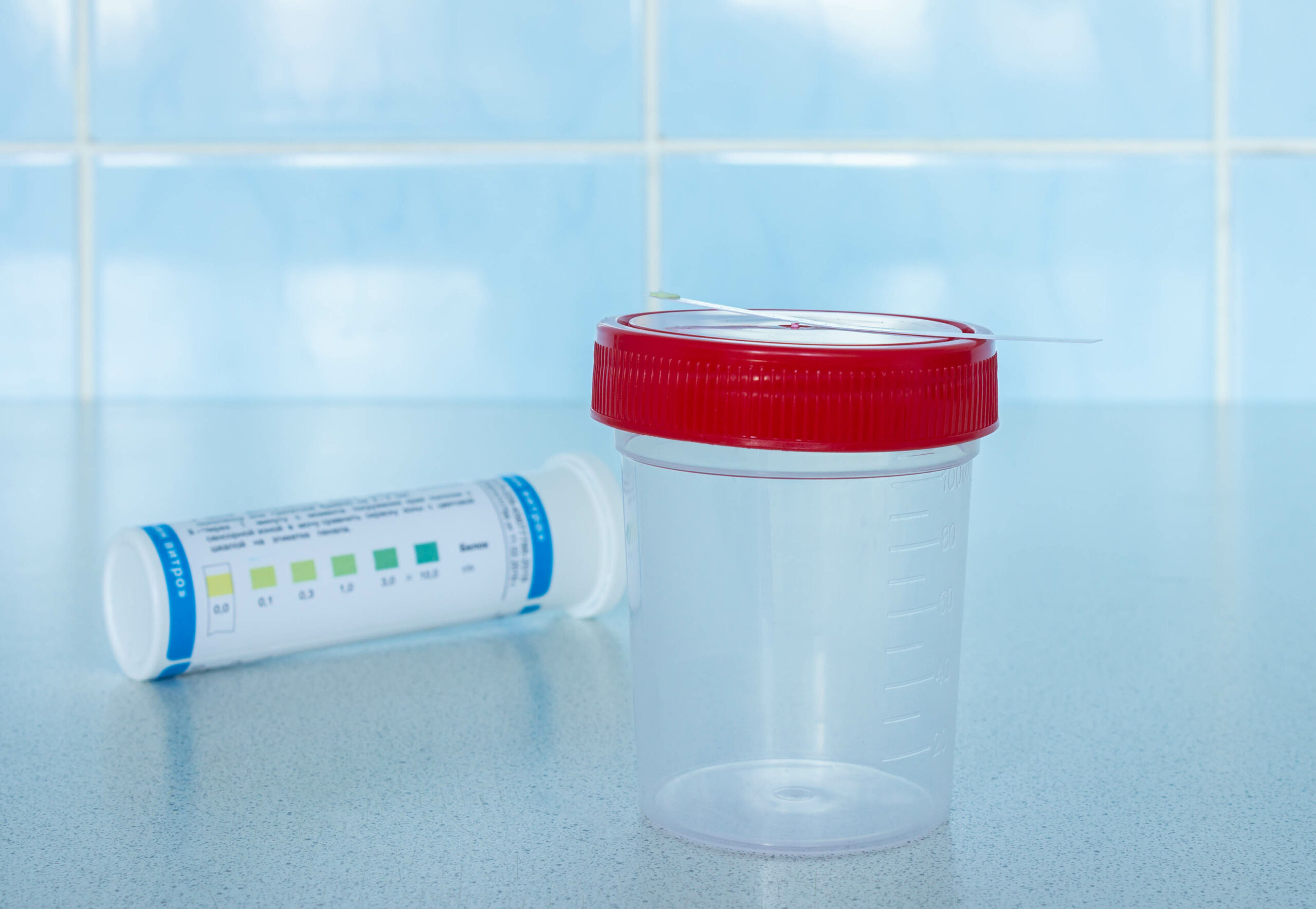 a jar for collecting urine analysis with test strips for determining protein in urine  at home