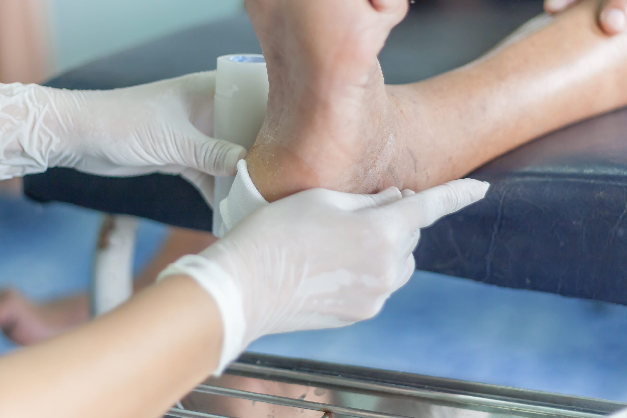 diabetes ulcers,treatment infected wound of diabetic foot