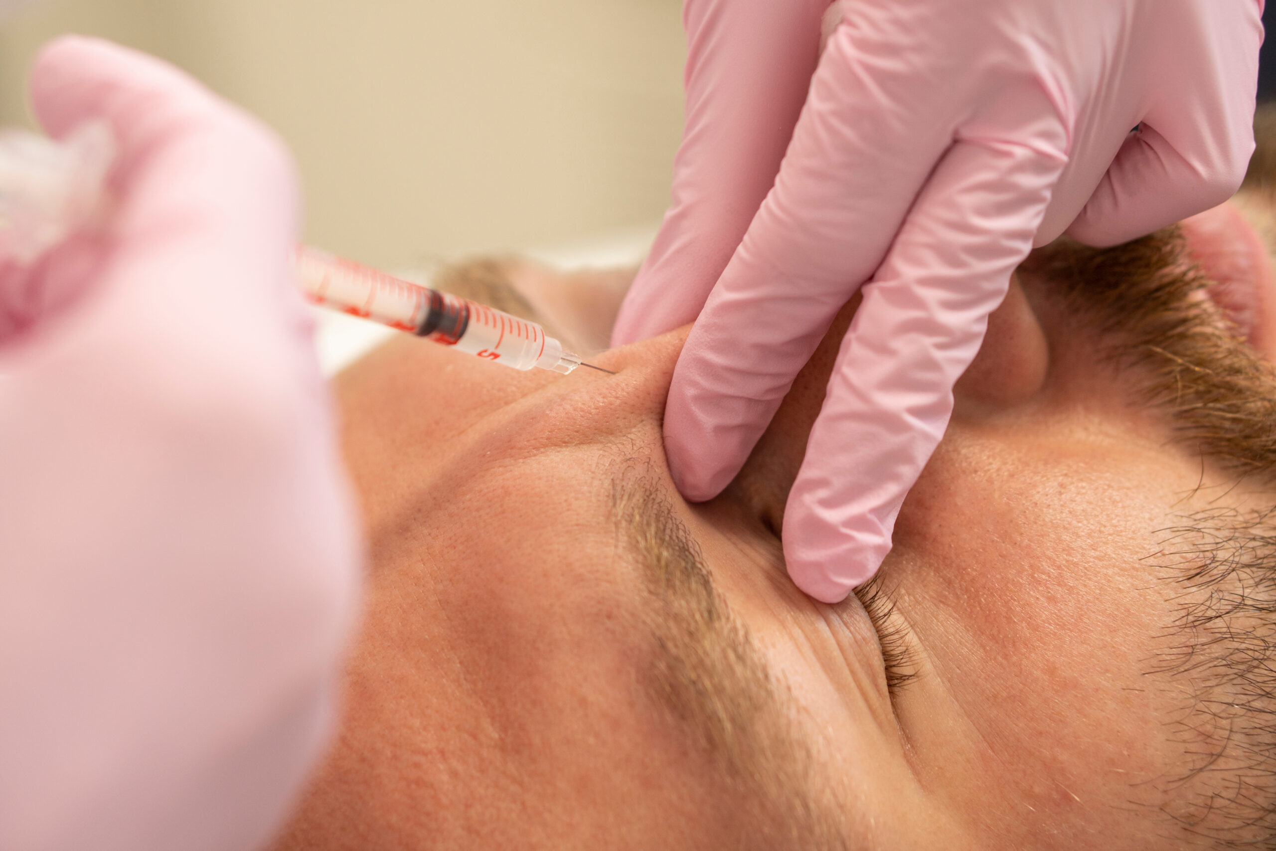 Men’s cosmetology. Close up Cosmetologist makes a man the procedure of beauty injection of botulinum toxin in the wrinkles of the forehead and bridge of the nose rejuvenation of a handsome man