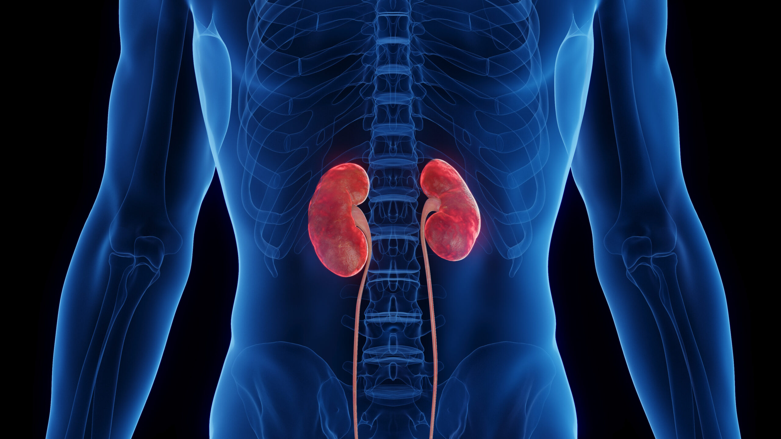 3D medical illustration of a man’s inflamed kidneys