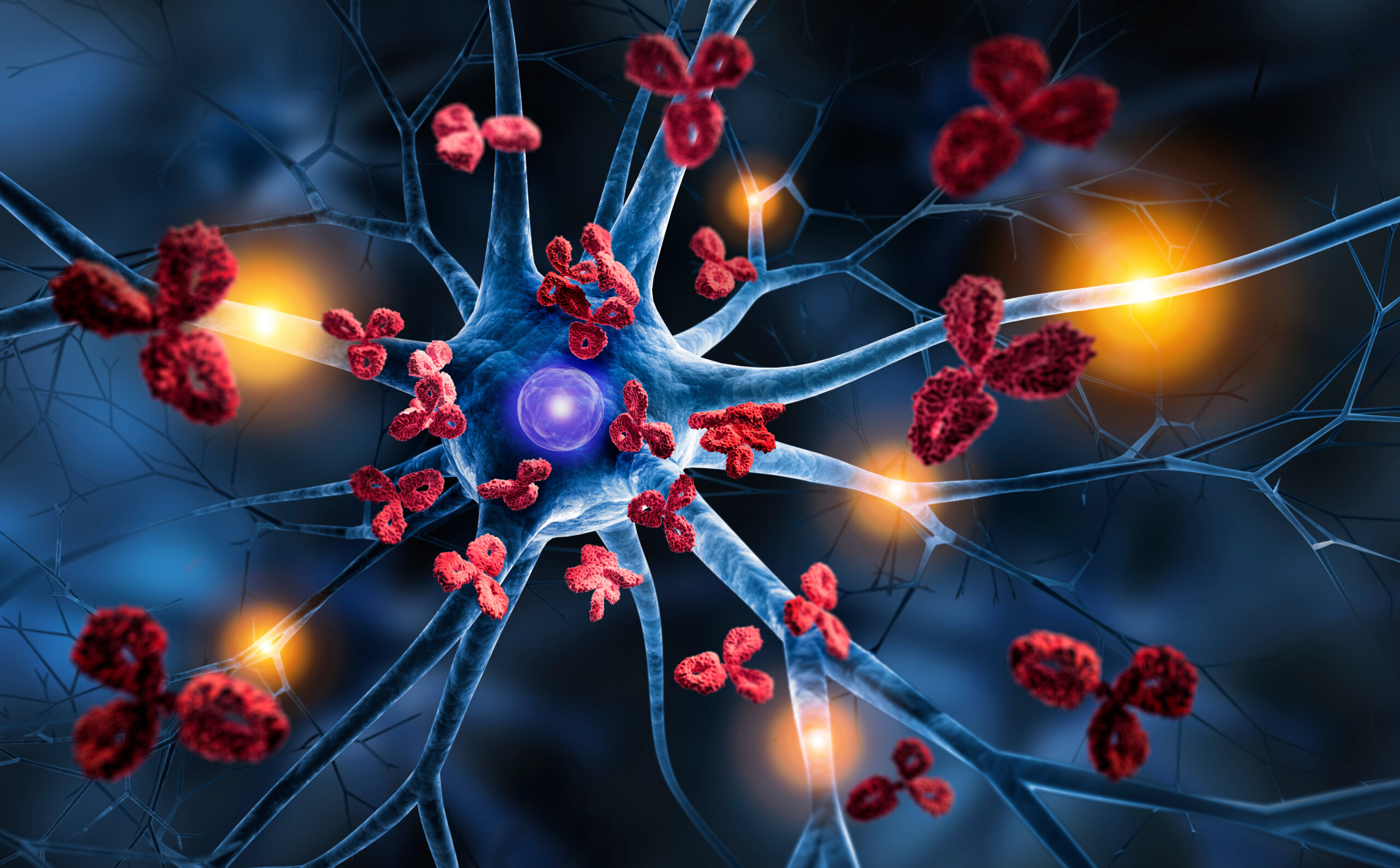 Nerve cells with Antibodies – Autoimmune disease