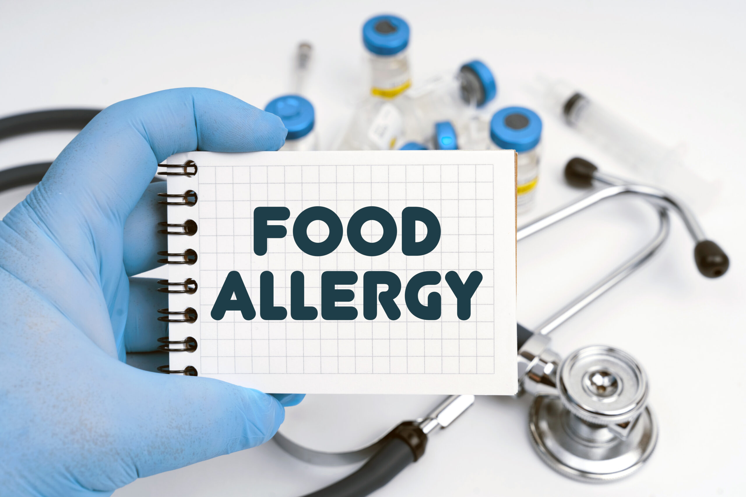 There is a stethoscope on the table, the doctor holds a notebook in his hand with the inscription – food allergy